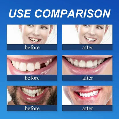 Ends Today: 70% OFF!  🏆2026 Bestselling Product🦷 Fit for a Fresh Smile, Say Goodbye to Wearing Discomfort!🌎