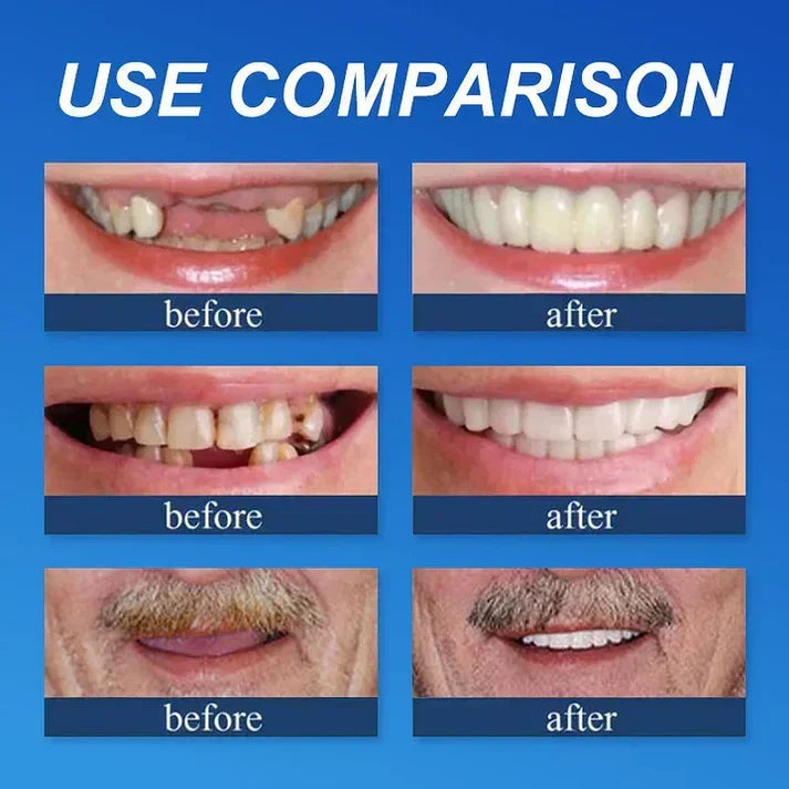 Ends Today: 70% OFF!  🏆2026 Bestselling Product🦷 Fit for a Fresh Smile, Say Goodbye to Wearing Discomfort!🌎